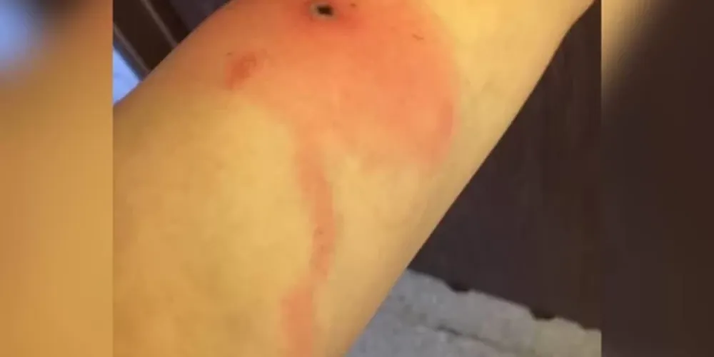 Vírus foi descoberto em 2015