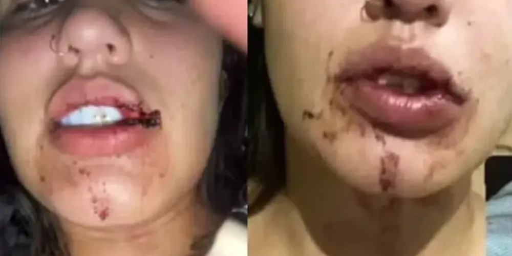 Jovem de 19 anos mostrou imagens de agressões que teriam ocorrido na festa