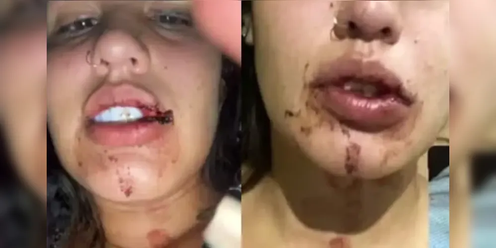 Jovem de 19 anos mostrou imagens de agressões que teriam ocorrido na festa