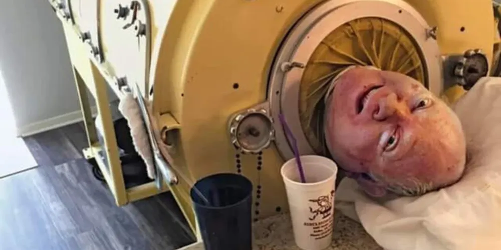 Alexander vive em pulmão de ferro devido a poliomielite