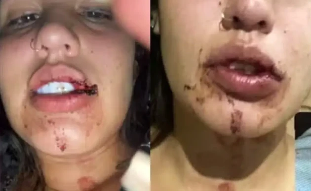 Jovem de 19 anos mostrou imagens de agressões que teriam ocorrido na festa