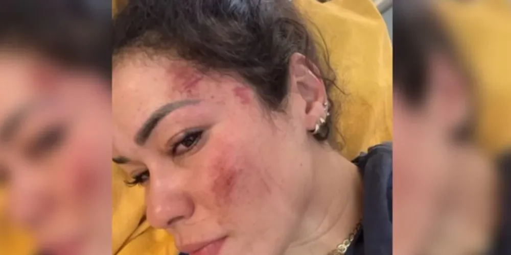 Ela e seu marido, que é espanhol, também foram espancados e tiveram alguns pertences roubados