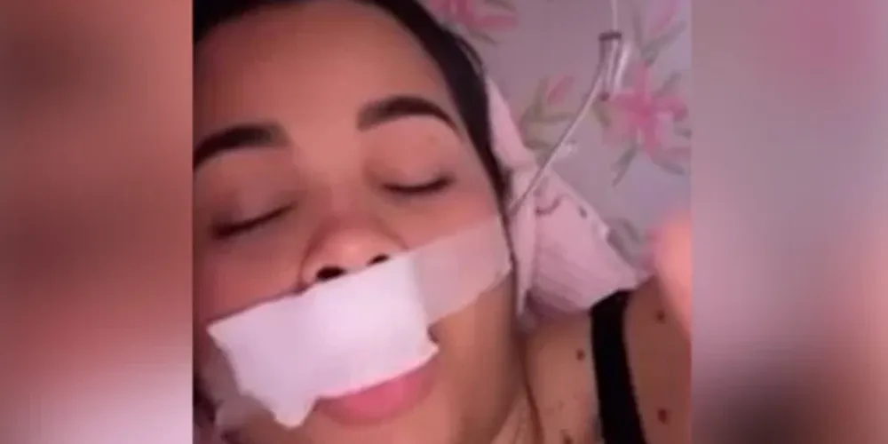 Ela levou 10 pontos no ferimento