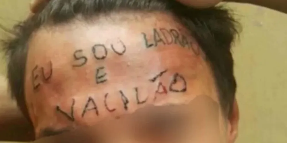 Jovem teve a testa tatuada por dois homens, em 2017
