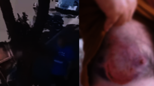 Região do peito do vereador ficou machucada após a mordida do animal