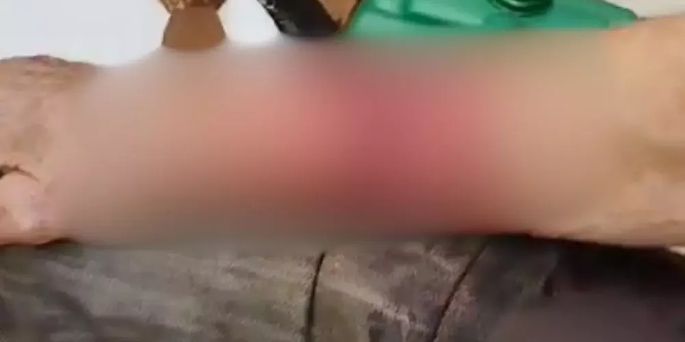 Avô e o neto foram encaminhados ao hospital