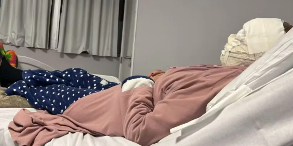 Mulher sofre queimaduras de segundo e terceiro grau após fazer peeling de fenol em Curitiba