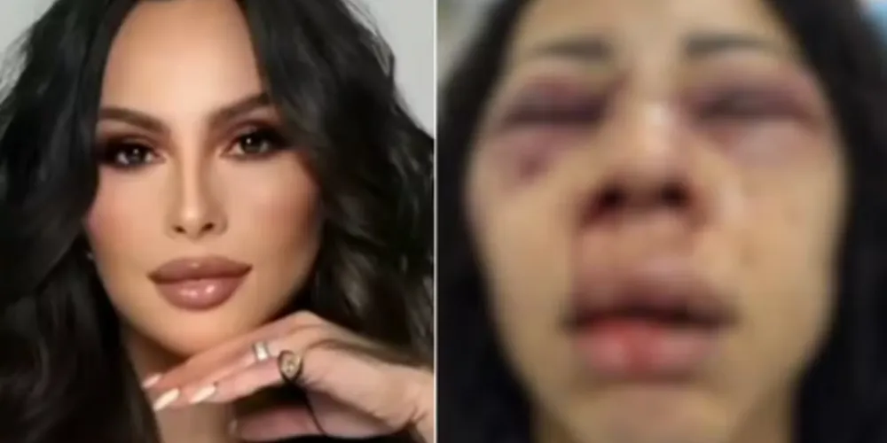 Turista brasileira está internada em estado grave