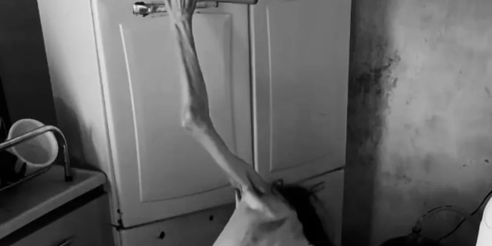 Mulher de 30 anos é portadora de necessidades especiais e estava desnutrida