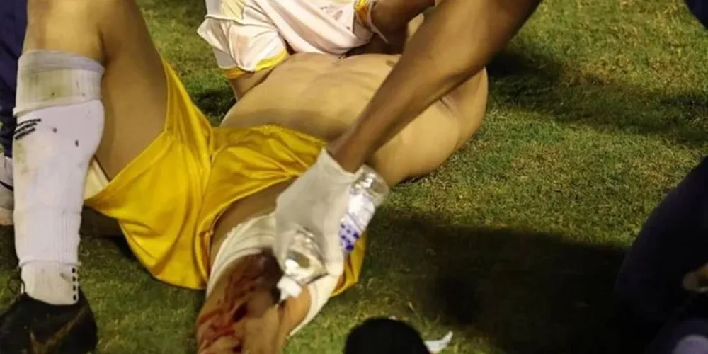 Policial atira dentro de campo na perna do goleiro Ramón