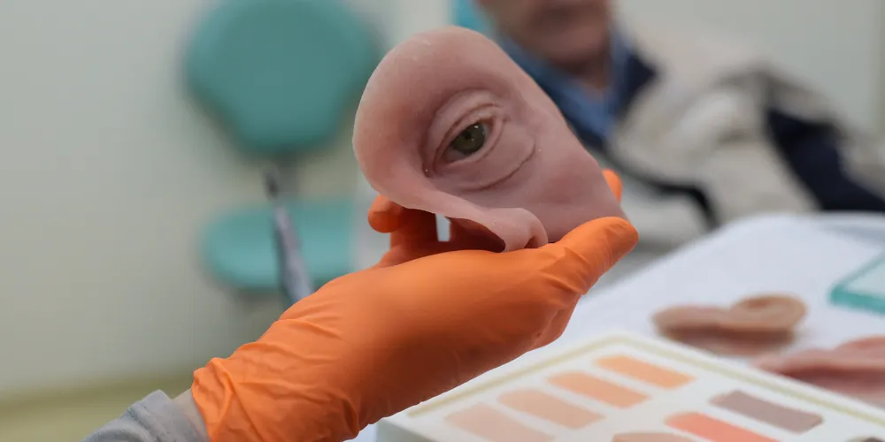 Ambulatório de próteses faciais reconstrutivas do Hospital de Reabilitação do Paraná