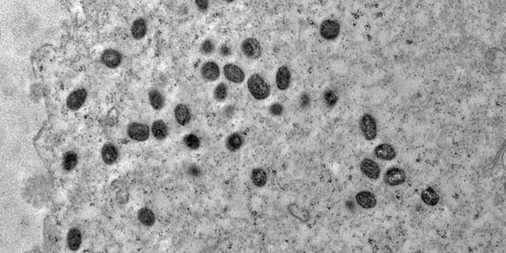 A OMS pede melhor coordenação da resposta à emergência por mpox