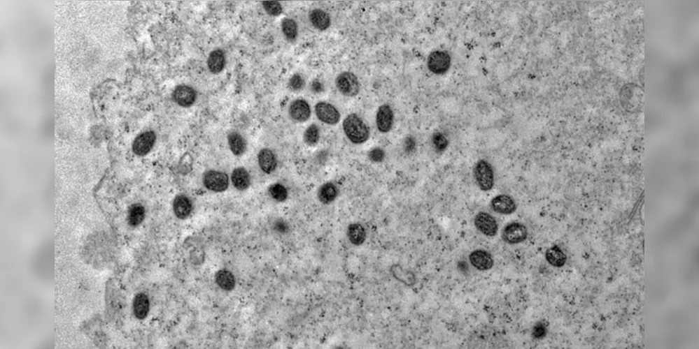 A OMS pede melhor coordenação da resposta à emergência por mpox