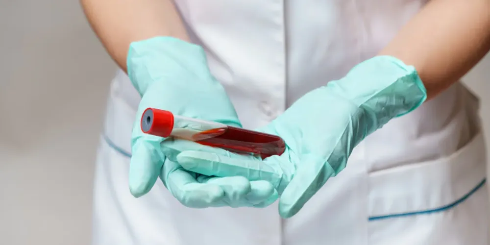 O teste detecta proteínas que indicam a presença ou a ausência de placas amiloides no cérebro