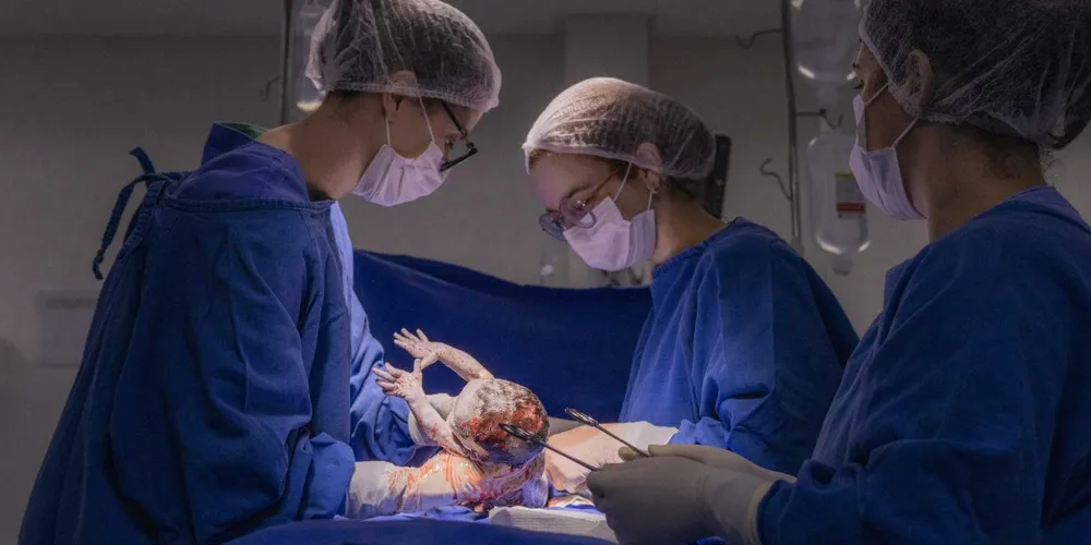 103 partos por cesariana foram realizados no Humai