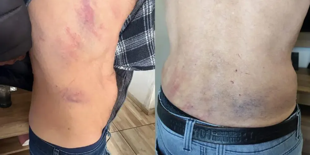 Idoso diz que foi levado a uma área de mata e espancado