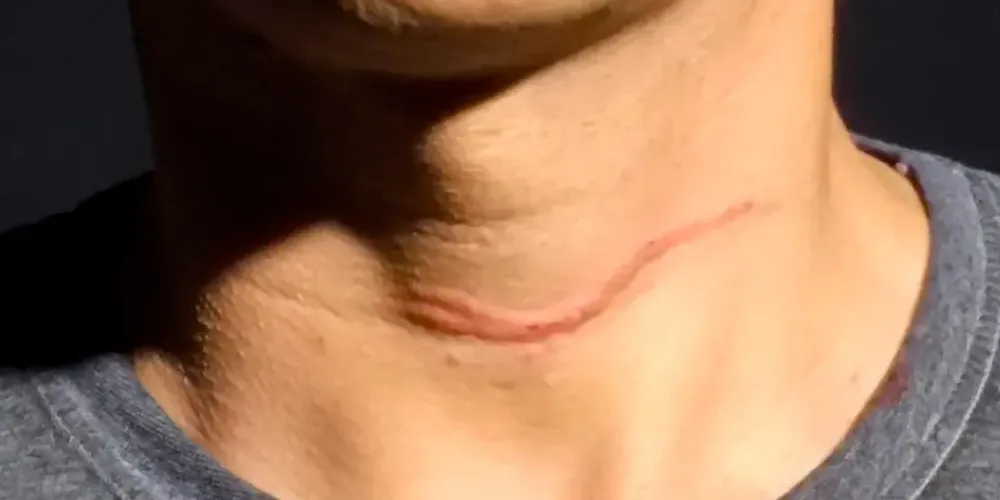 Um dos assaltantes o ameaçou com uma pistola e o outro colocou uma faca no pescoço dele