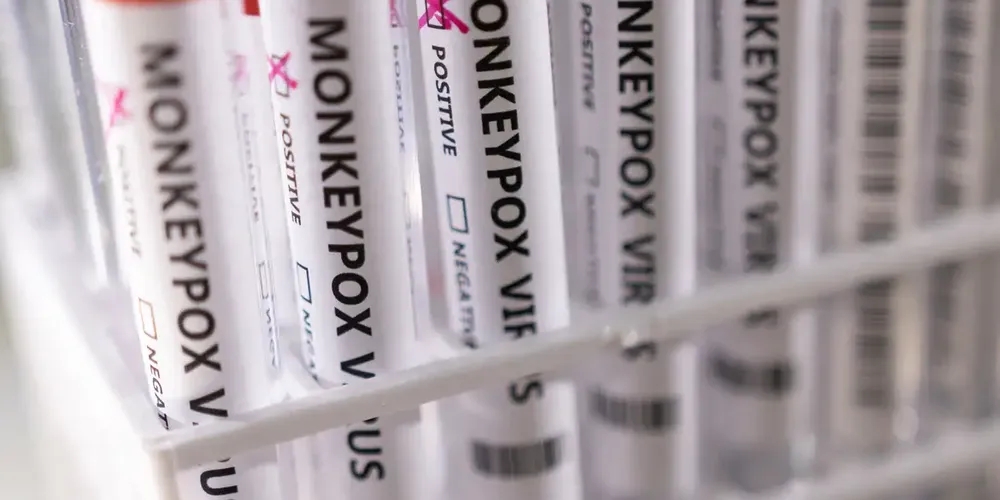 Casos de mpox no Brasil este ano já superam o total de 2023