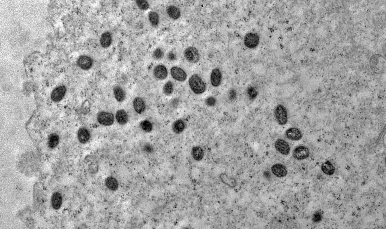 A OMS pede melhor coordenação da resposta à emergência por mpox