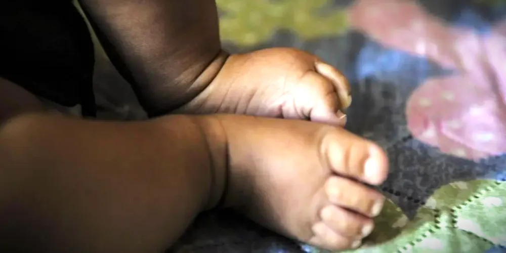 Bebê ficou internado sob cuidados intensivos, em Cascavel