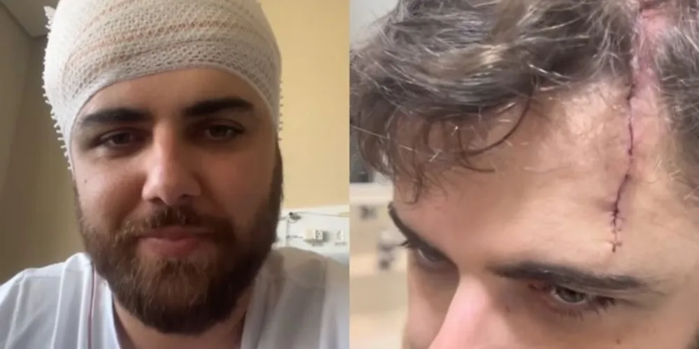 Zé Neto mostra corte na cabeça, após acidente