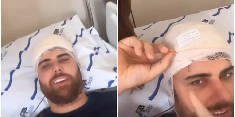 Cantor apareceu com a cabeça machucada nas redes sociais