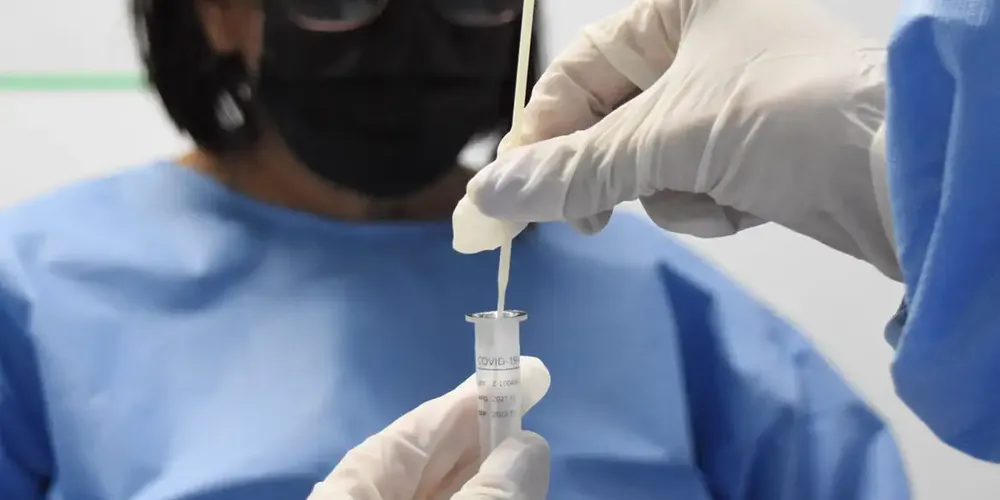 Dados são da pesquisa Epicovid 2.0