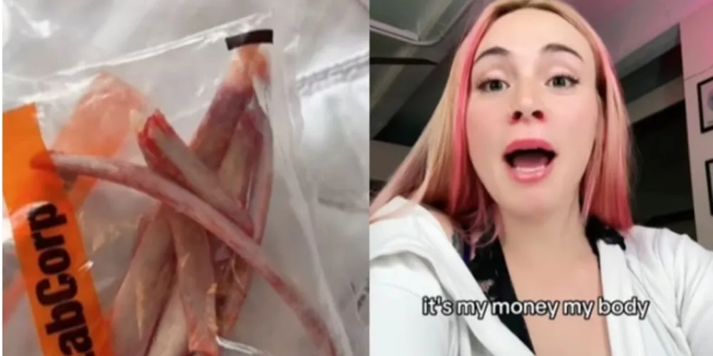 James usou as redes sociais para compartilhar a jornada da cirurgia