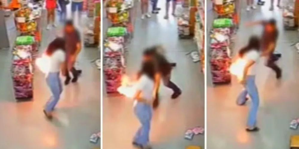 As queimaduras atingiram as costas, o bumbum, as mãos e um braço da jovem