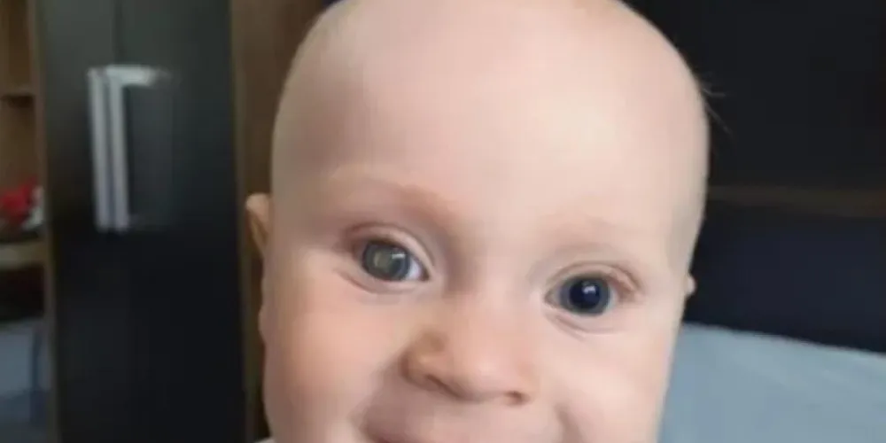 Luan de nove meses recebe tratamento em hospital de São Paulo