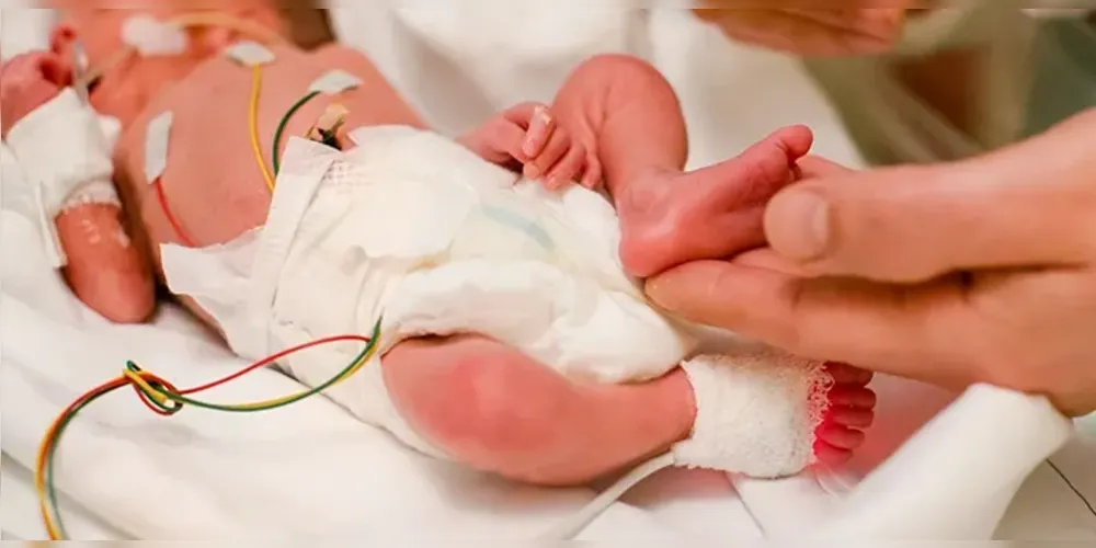 Brasil tem média de nascimentos prematuros maior do que o restante do mundo