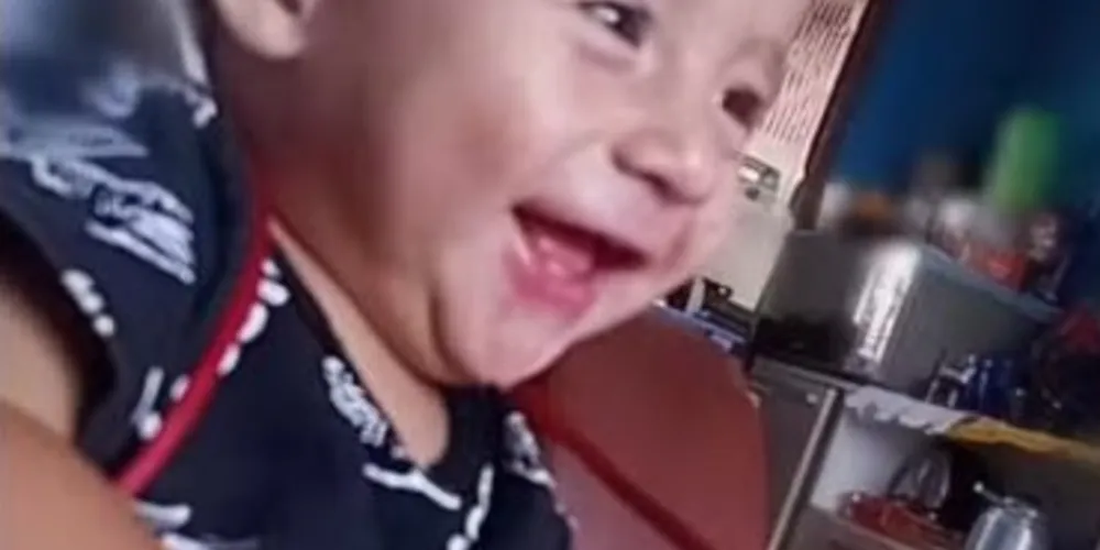 Bebê de um ano foi atacado por um Rottweiler