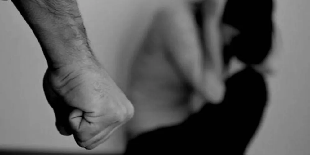 Mulher foi vítima de lesão corporal na quarta-feira (29), em Irati, nos Campos Gerais; suspeito da agressão é o companheiro