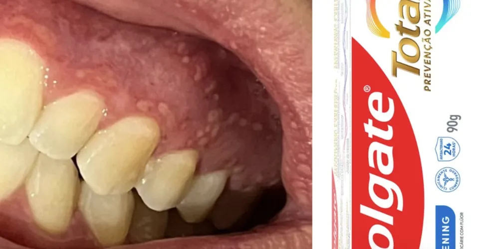 Interdição do produto tem prazo previsto de 90 dias