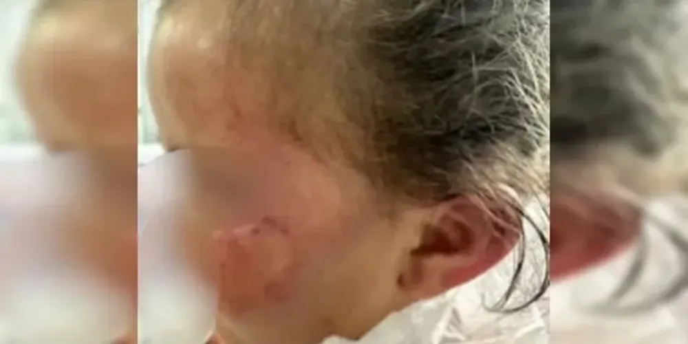 Caso foi registrado em Bela Vista de Goiás, na terça-feira (15)