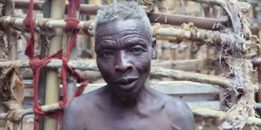 Callixte Nzamwita sofre de ginofobia desde os 16 anos