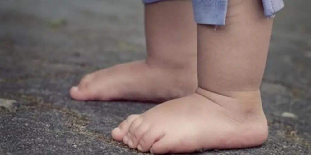 O bebê apresentava duas costelas quebradas