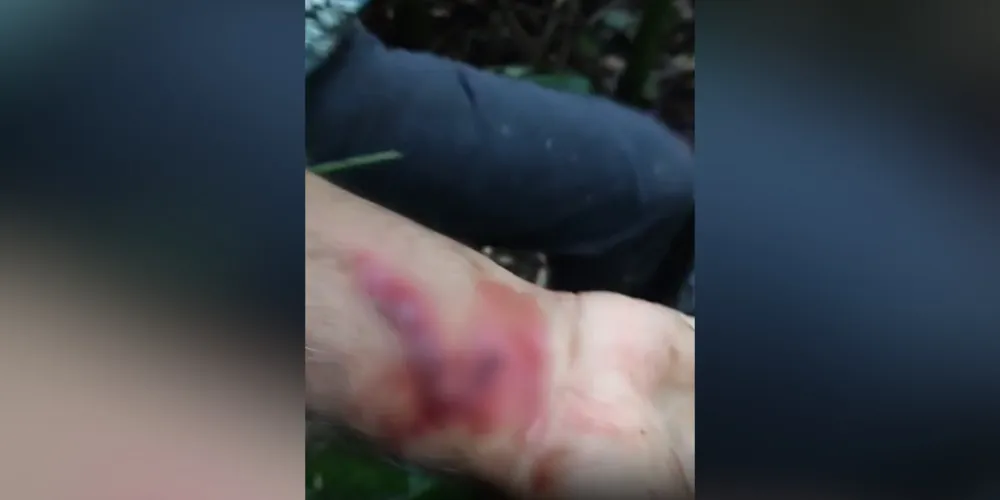 Um dos homens que participava da ação foi atacado e teve o braço ferido por um golpe da onça