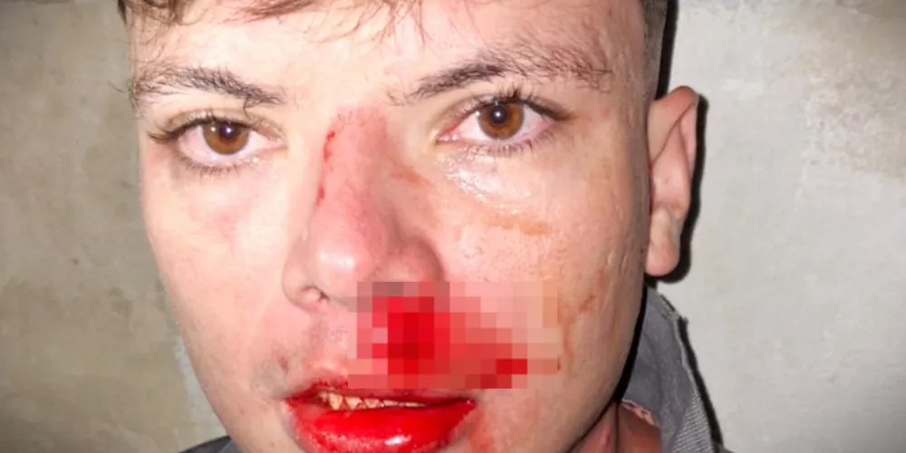 Henrique Lobachinski tentou intervir na briga, quando foi violentamente agredido