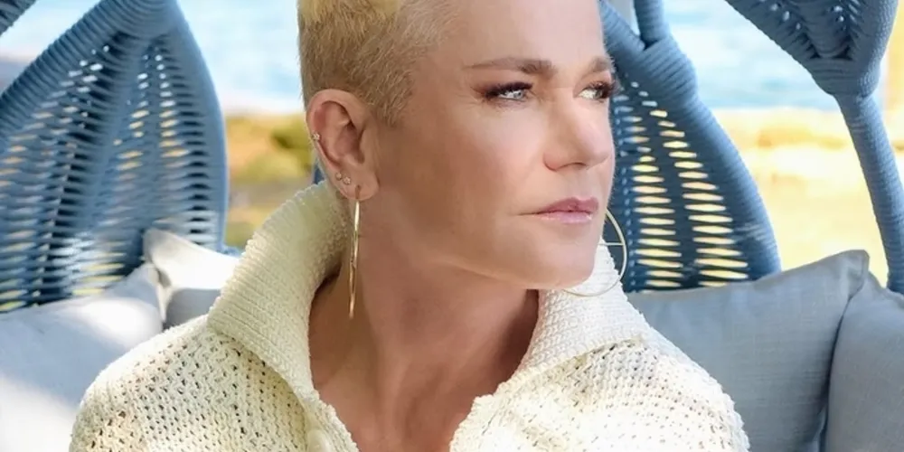 Rainha dos Baixinhos sofre de alopecia androgenética