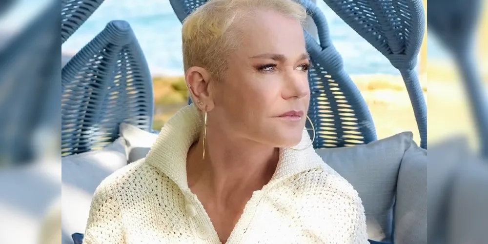 Rainha dos Baixinhos sofre de alopecia androgenética