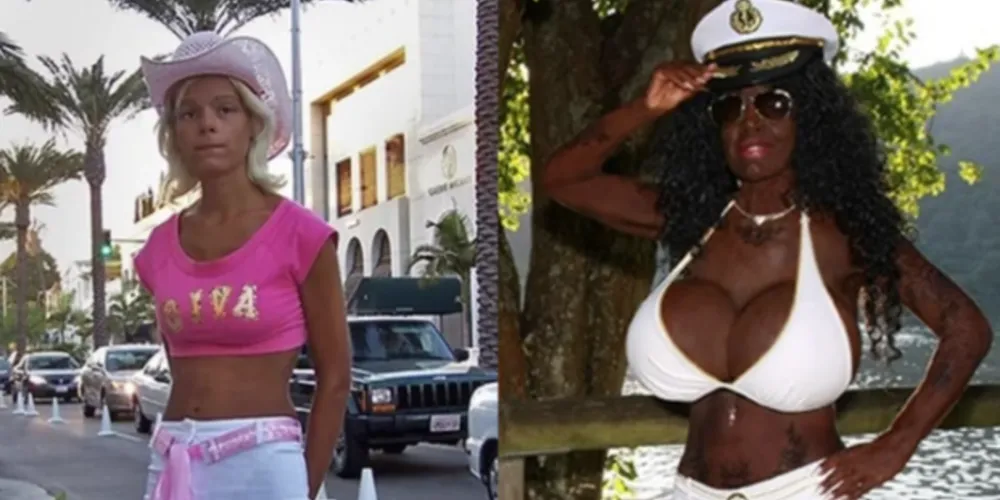 Conhecida por suas drásticas transformações corporais, incluindo os seis litros de implantes de silicone em cada seio, Martina passou a adotar o nome de Malaika Kubwa