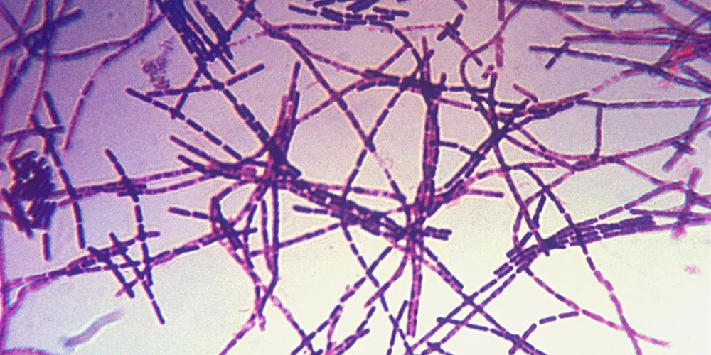 Infecção é causada pela bactéria Bacillus anthracis