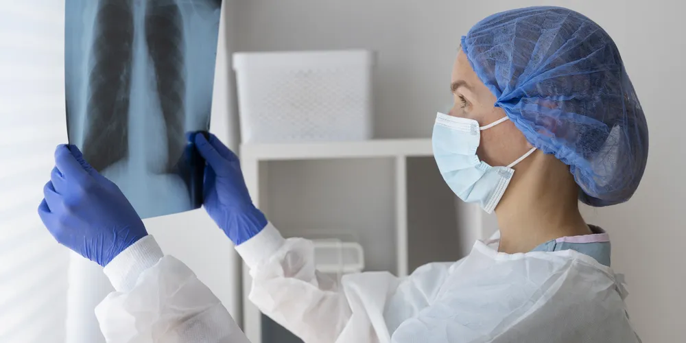 Entre 2023 e 2025, estima-se uma média anual de 32 mil novos casos de câncer de pulmão no Brasil