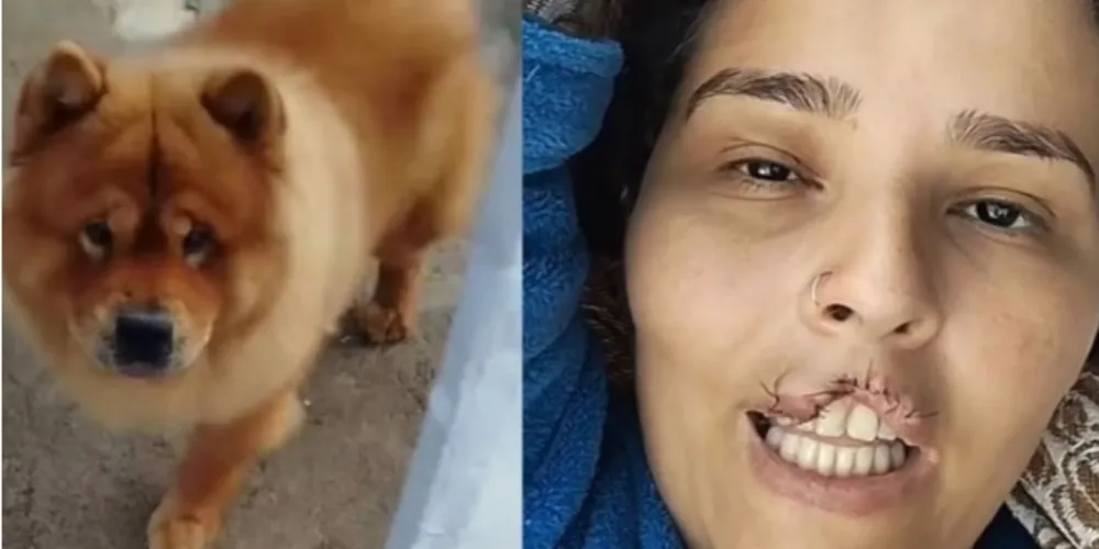 Além da dor física, Natani disse ter sofrido impactos emocionais