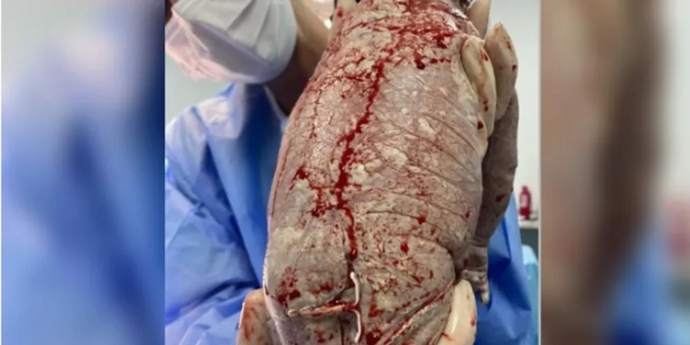 Bernardo nasceu com 35 semanas e 5 dias