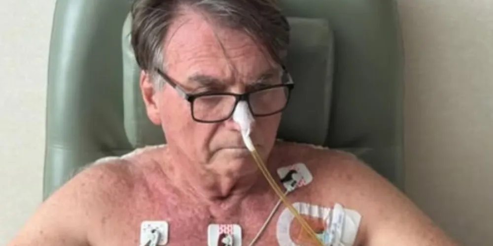 Jair Bolsonaro está sendo alimentado artificialmente por uma  nutrição parenteral total (NPT)