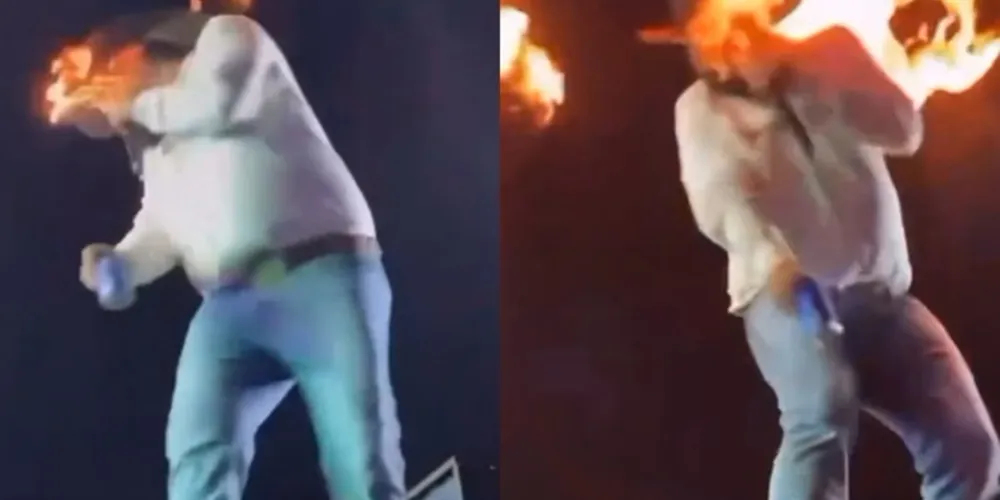 Cantor ficou com o rosto incendiado por alguns segundos