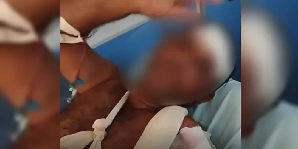 Homem sofreu vários cortes nos braços, ombro, rosto e outras partes do corpo