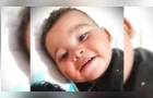 Bebê morre vítima de infecção generalizada por meningite em PG